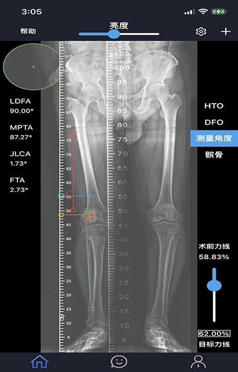 华保膝望软件截图1