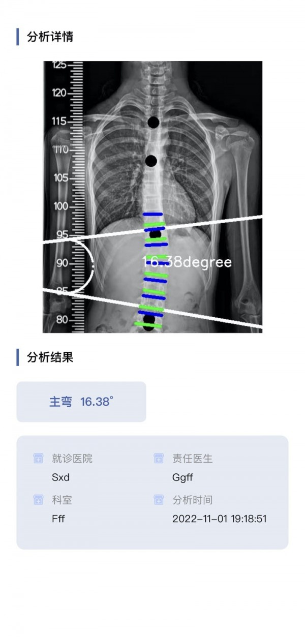 筠成矫形软件截图1