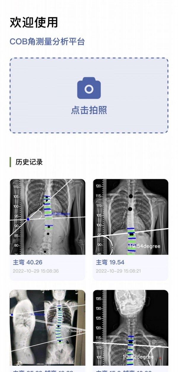 筠成矫形软件截图2