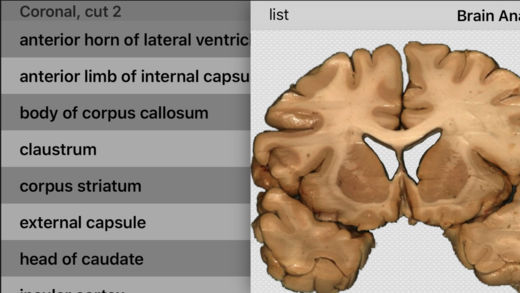 Brain Anatomy软件截图1