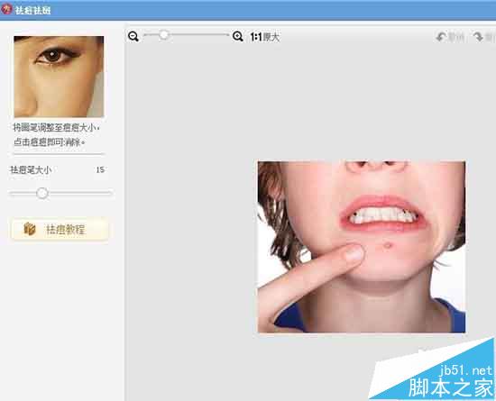 超级好啊！美图秀秀怎么去除照片中的痘痘和斑祛?