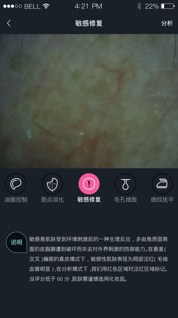 护肤AI检测软件截图3