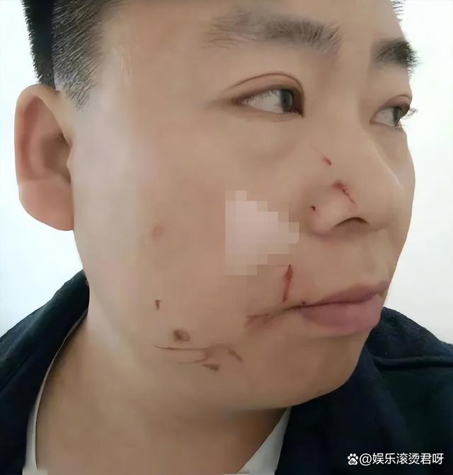 迪丽热巴被恶意p亲密视频  男子合成迪丽热巴视频是否属于性骚扰