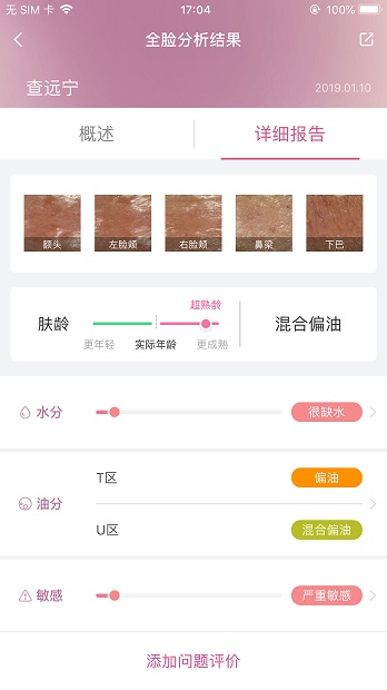 肌肤分析仪本软件截图0