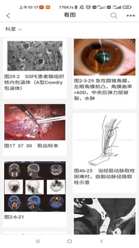 人卫临床助手软件截图4