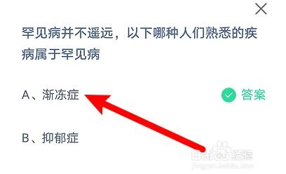 罕见病并不遥远以下哪种人们熟悉的疾病属于罕见病