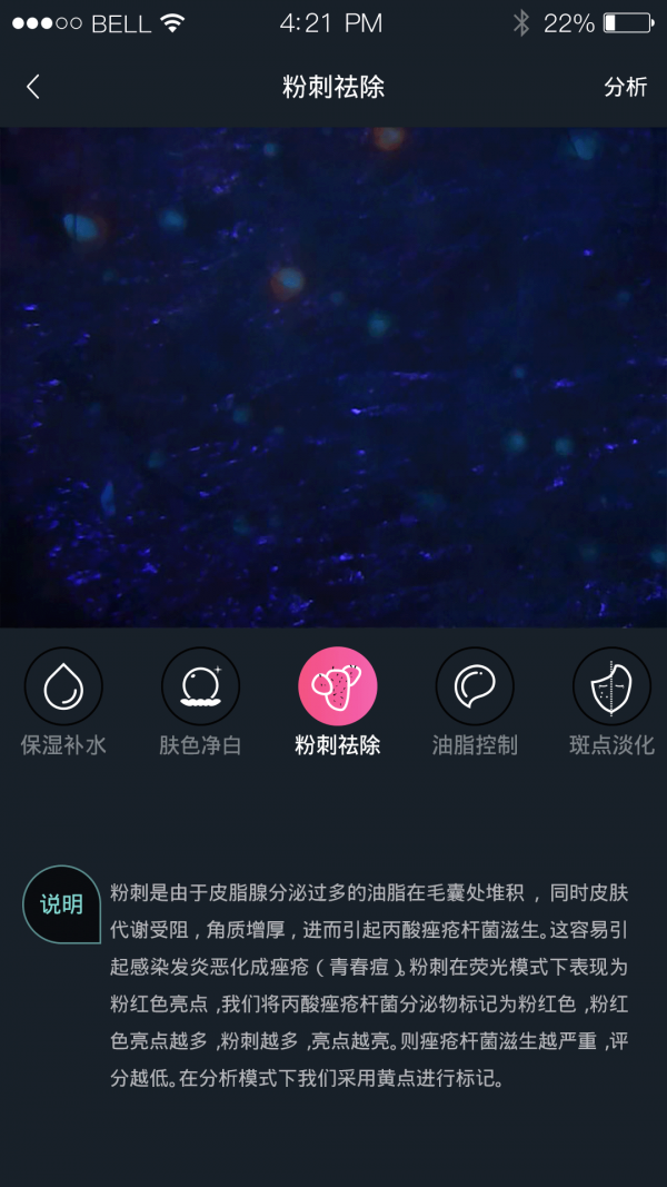 护肤AI检测软件截图2