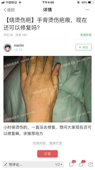 中国疤痕论坛软件截图0