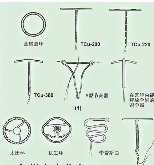 艾尔登法环老寒腿在哪里