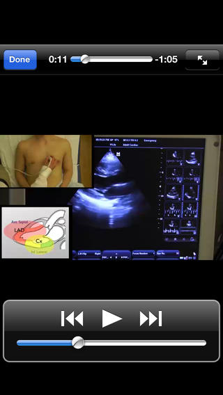 One Minute Ultrasound软件截图1